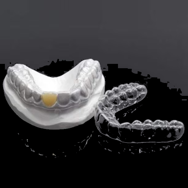 Clear Essix Pontic Retainer