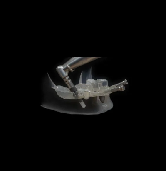Surgical Implant Guide