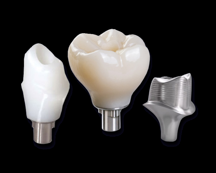 Custom Abutment